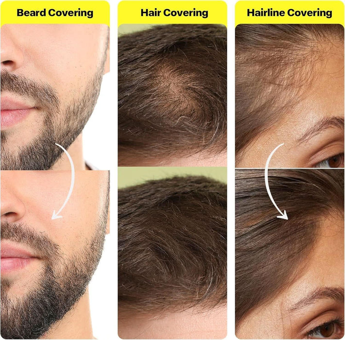 2 Pack] Hairline Powder Instantly Conceals Hair Loss – Root Touch Up Powder | Gray Hair Cover Up for Women & Men | Hair Fibers for Thinning Hair | Stain - Proof 48 Hours (Black) - Battery Mate