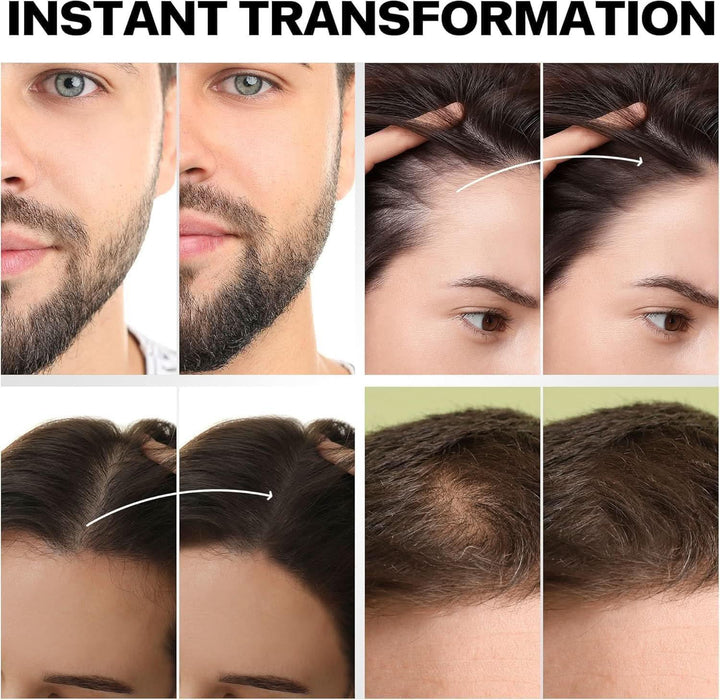 [3 PACK] PROVE Nothing 86g VALUE PACK PN Hair Fibers for Thinning Hair & Bald spots (DARK BROWN) - 3x 28g Bottles - Conceals Hair Loss in Seconds - Hair Powder for Women & Men | Designed in Australia (Medium Brown) - Battery Mate