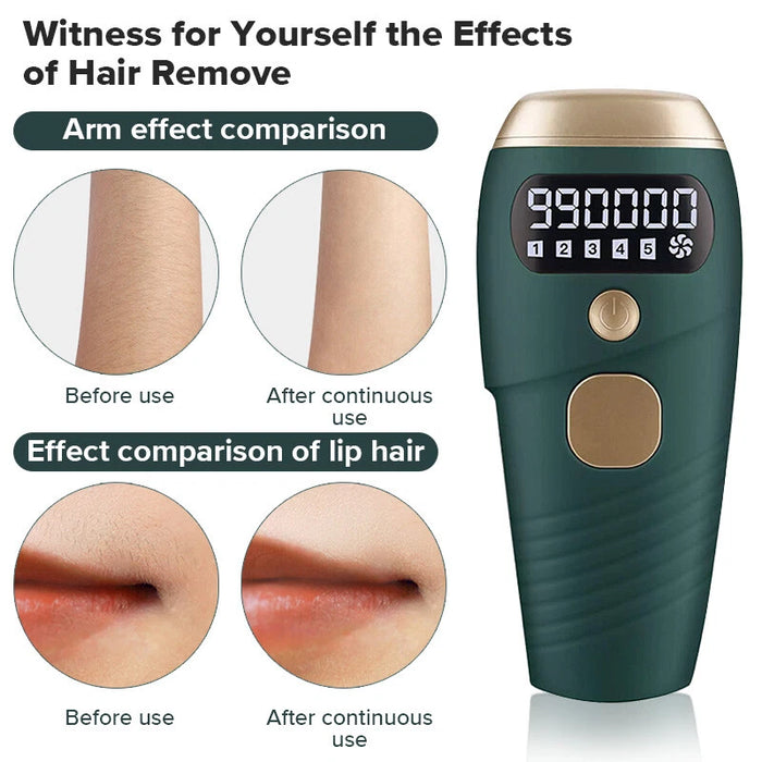 TAVICE IPL Hair Removal Device for Women and Men, 990,000 Flashes, At-Home Intense Pulsed Light Hair Remover for Face, Arms, Legs, Underarms, Bikini Line and Body
