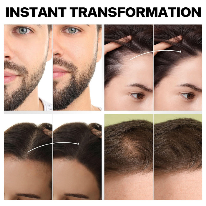 PROVE NOTHING Hair Fibres (28g) Instantly Fuller, Thicker Look Windproof & Sweatproof | Women and Men | Designed in Australia (Medium Brown) - Battery Mate